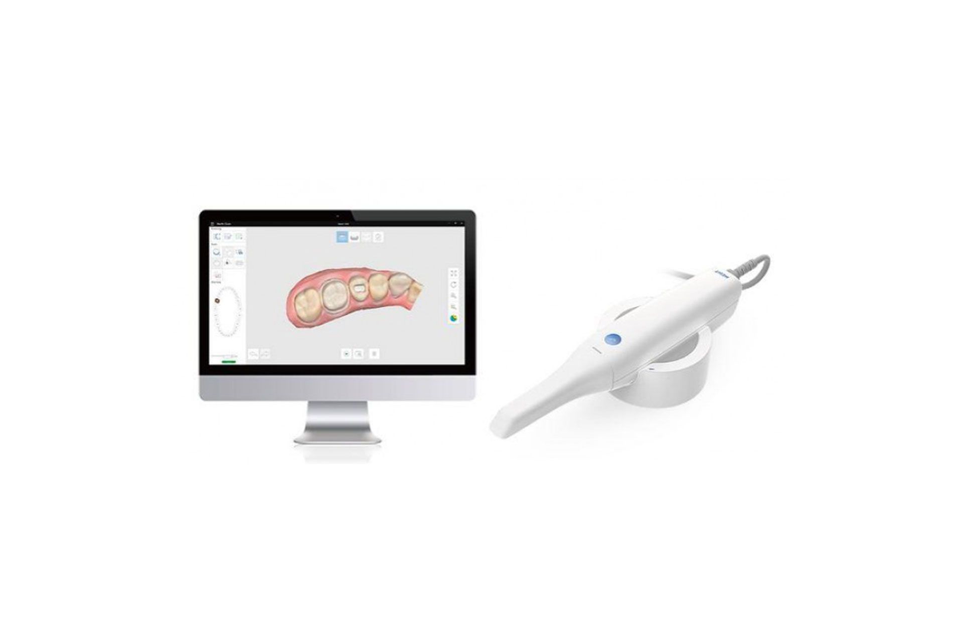 Digitaler Zahnscanner